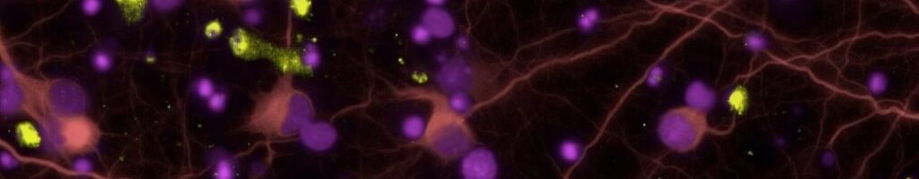 in vitro neurology result in banner format