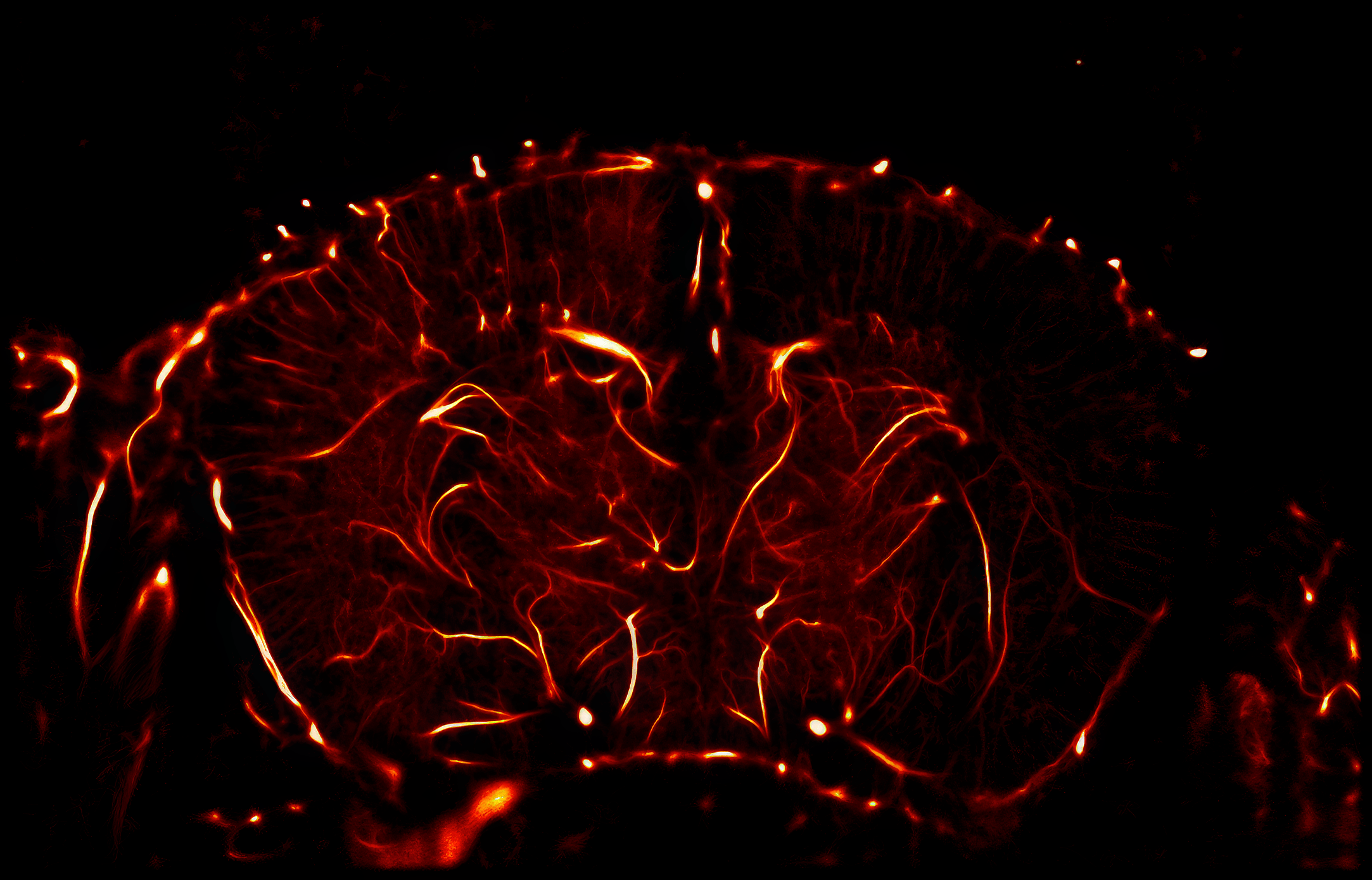 in vivo imaging coronal_absolute density post alcL3 Fire ULM