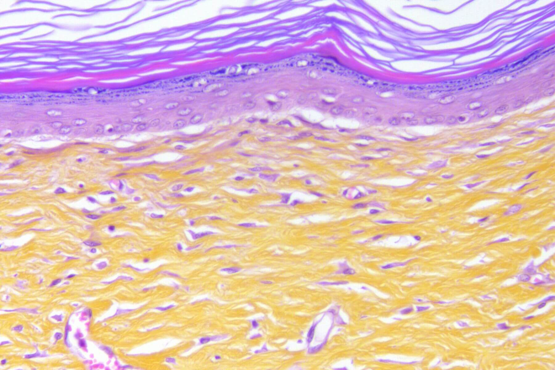 preclinical dermatology results x40 of fully recovered skin