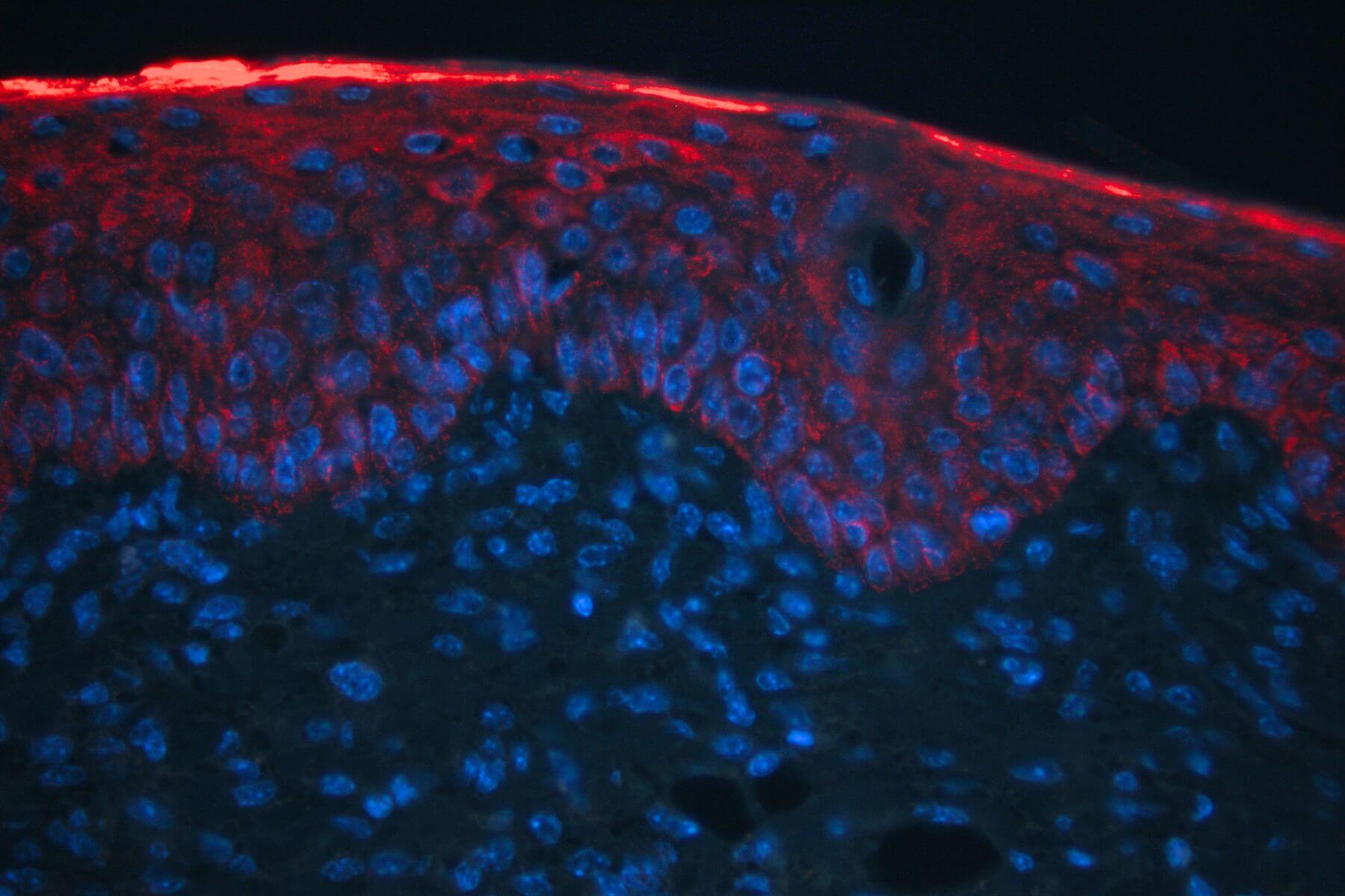 preclinical dermatology result on psorisais model skin x40