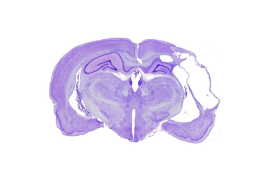 histology on brain for stroke pathology-purple-coloured