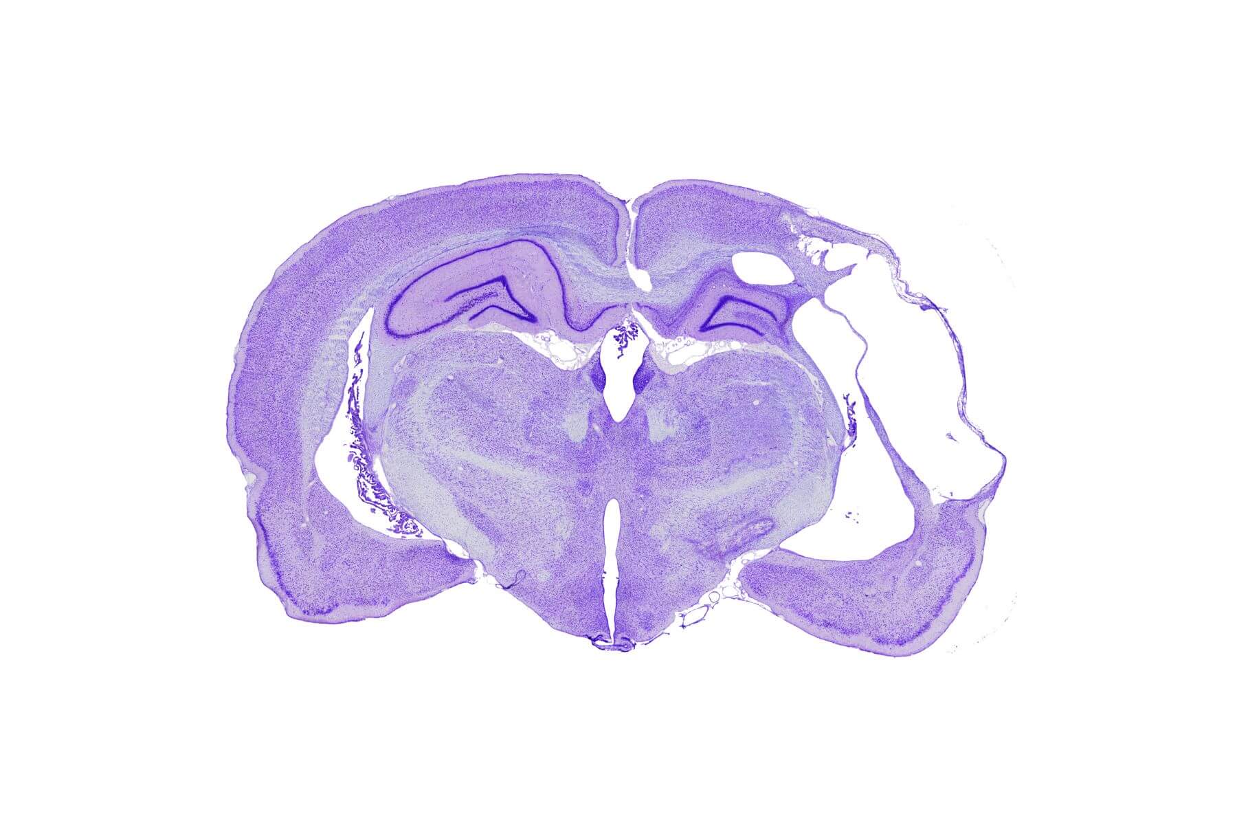 Neurovasculaire & AVC – stroke histology violet