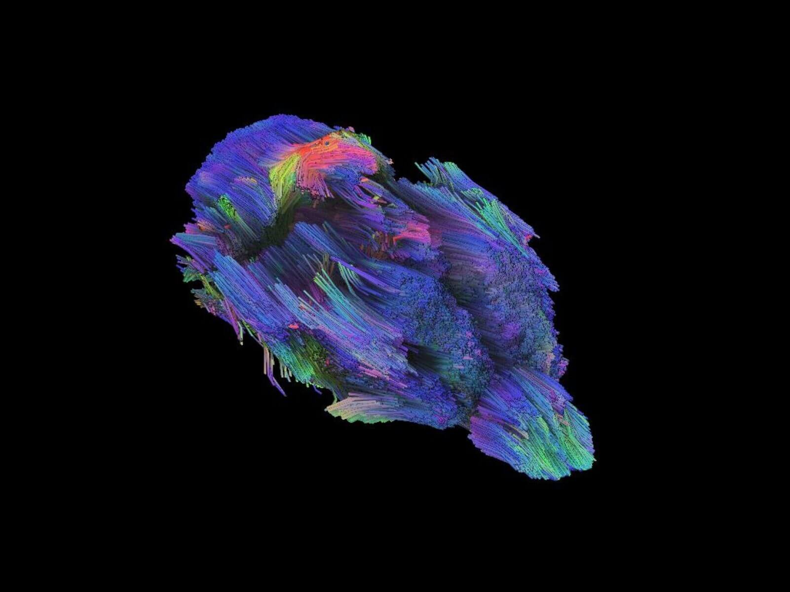 stroke-invivo-tracto imaging